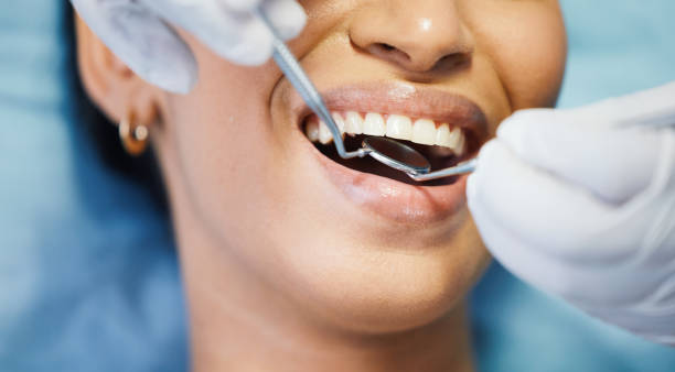 Best Emergency Cosmetic Dentistry (e.g., broken veneers) in Moreauville, LA